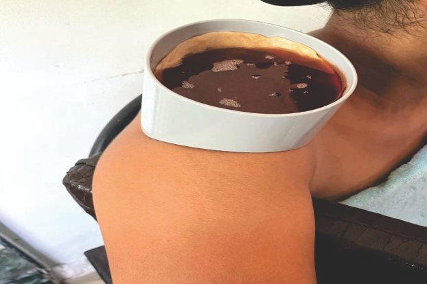 Ansabasti Ayurvedic Shoulder Joint Basti Therapy