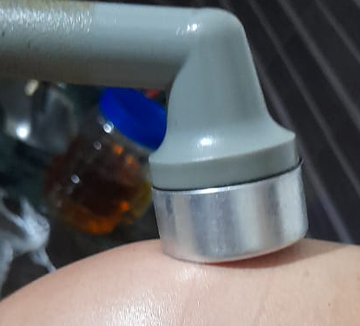 Ultrasonic Vibration Therapy for Pain Relief